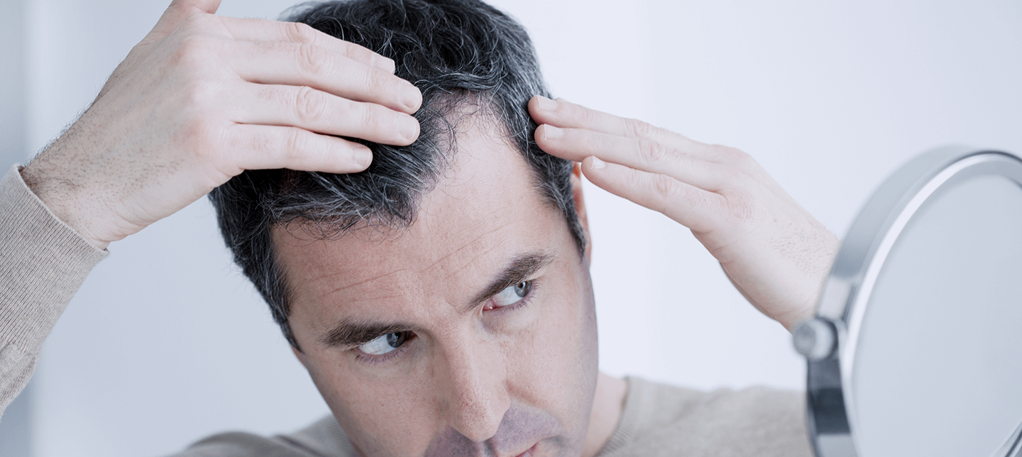 Onion Juice For Hair Regrowth Male Pattern Baldness Best Natural